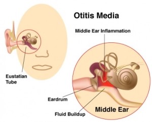 Ear Pain/Ear Infection NYC