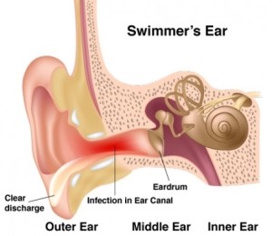 Ear Infection and Ear Pain NYC
